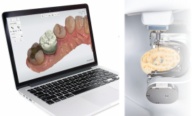 栃木県真岡市でインプラント治療なら｜勝田デンタルクリニックインプラント治療の流れ