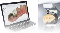 栃木県真岡市でインプラント治療なら｜勝田デンタルクリニックインプラント治療の流れ